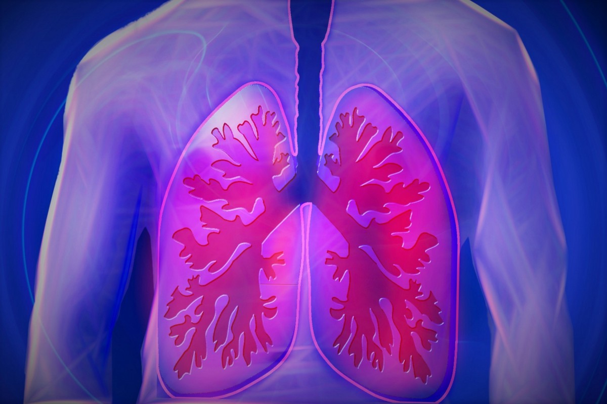 Image:Society Fellow identifies the cause of wheezing in the Lungs